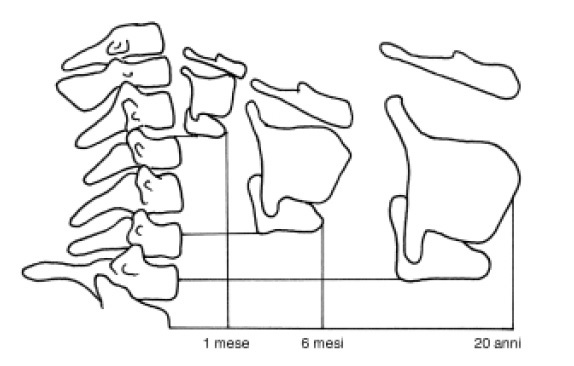 fig. 1 posizione della laringe nelle diverse fasce d’età rispetto alle vertebre cervicali